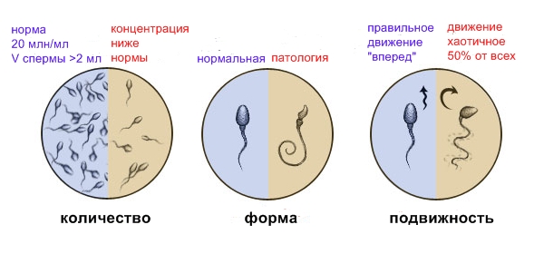 Suurenenud liikme sperma